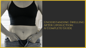 Understanding Swelling After Liposuction: A Complete Guide
