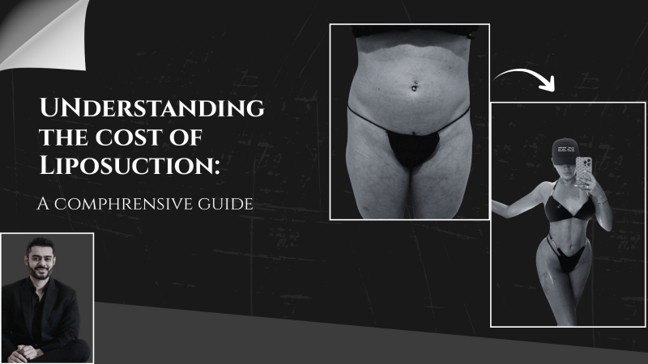 Cost of Liposuction in Dubai (2026)