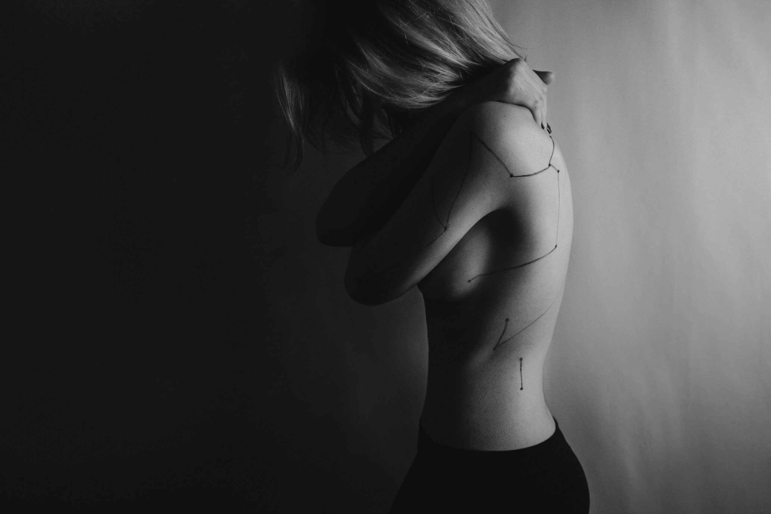 Fixing Botched Lipo: What Actually Went Wrong — and How to Fix It