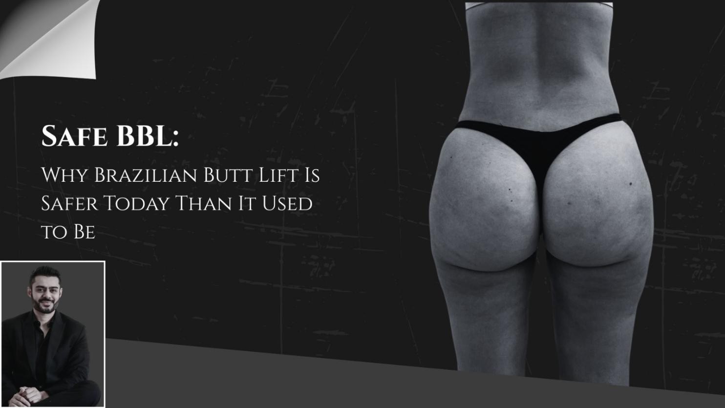 Safe BBL: Why Brazilian Butt Lift Is Safer Today Than It Used to Be