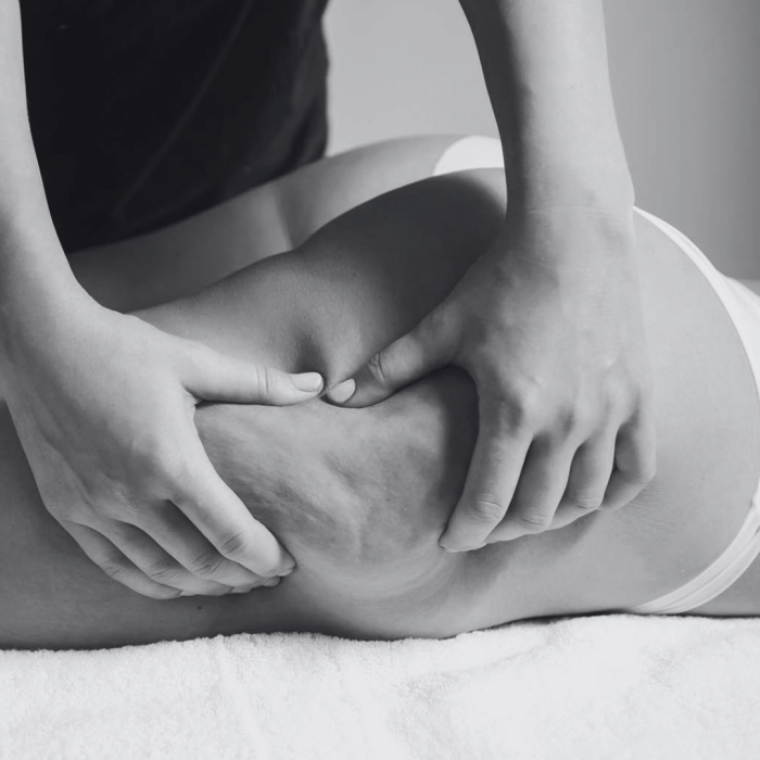 Cellulite treatment (2)